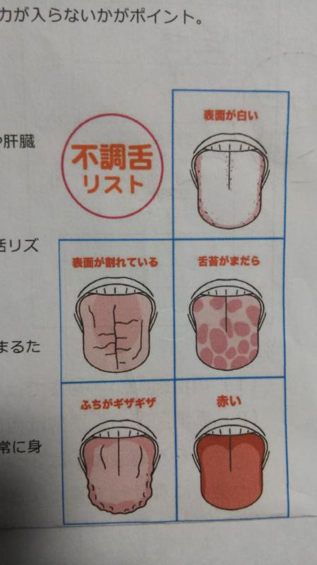 舌は健康の鏡