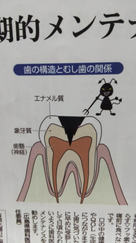 歯の寿命を長くしましょう!