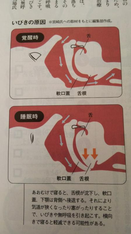 「いびき・睡眠時無呼吸症」