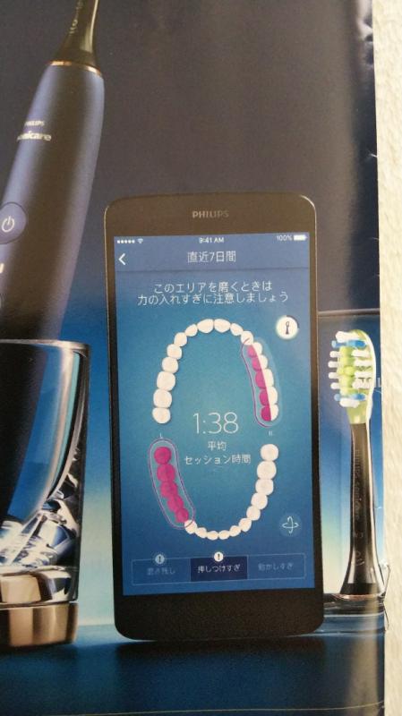 電動歯ブラシ