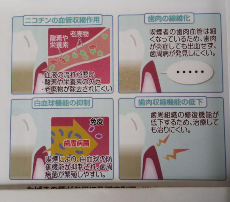 喫煙とお口の関係